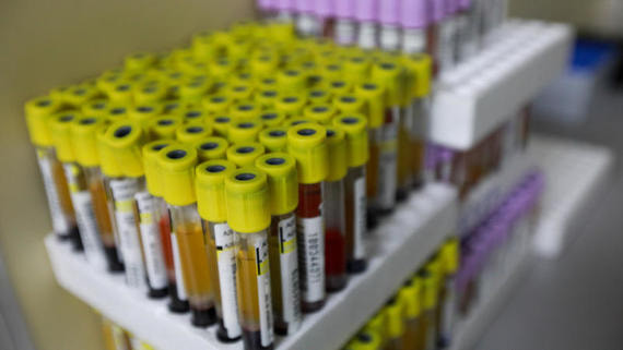 В России за сутки выявили 21 000 новых случаев коронавируса
