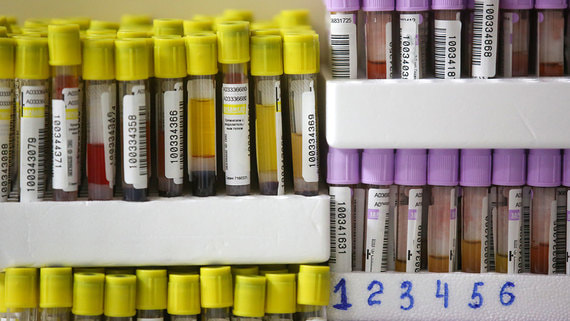 Лабораториям не хватает людей