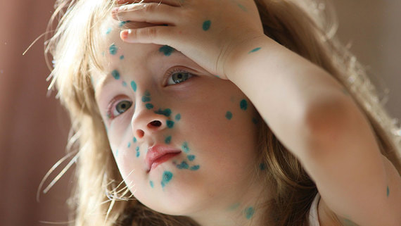 Вакцины от ротавируса и ветрянки не вошли в национальный календарь профилактических прививок