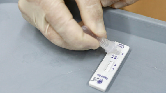 ФМБА сообщило о регистрации тест-системы для выявления «омикрона»