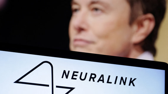 Илон Маск анонсировал выпуск импланта от Neuralink для восстановления зрения