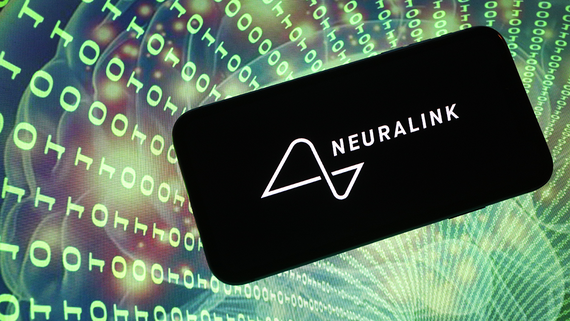 Власти США разрешили Neuralink вживить мозговой имплант второму пациенту